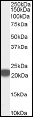 AP22542PU-N - PEBP1 / RKIP
