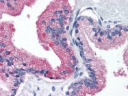 AM20523PU-N - Beta-2-microglobulin