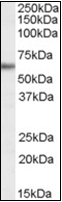 AP22547PU-N - G6PD