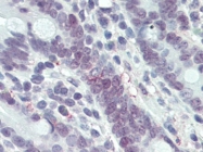 AM20522SU-N - MLH1