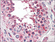 AP22551PU-N - COX IV isoform 1