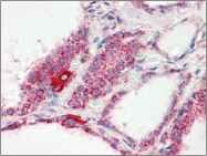 AP22551PU-N - COX IV isoform 1