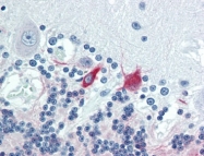 AM20513PU-N - MAP-2