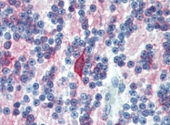 AM20513PU-N - MAP-2