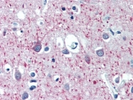 AM20513PU-N - MAP-2
