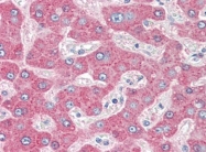 AM20505PU-N - Alpha-1-antitrypsin