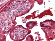 AM20505PU-N - Alpha-1-antitrypsin