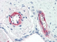 AM20504PU-N - Coagulation factor VIII (F8)
