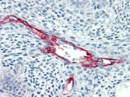 AM20504PU-N - Coagulation factor VIII (F8)
