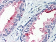 AM20502PU-N - PSMA / FOLH1