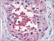 AP22560PU-N - CD184 / CXCR4