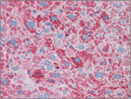 AP22563PU-N - Apolipoprotein A I / APO AI