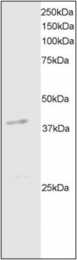 AP22565PU-N - DAPK2 / DRP-1