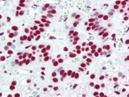 AP22851PU-N - Acinus / ACIN1