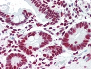 AP22851PU-N - Acinus / ACIN1