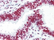 AP22851PU-N - Acinus / ACIN1