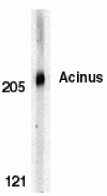 AP22851PU-N - Acinus / ACIN1