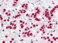 AP22852PU-N - Acinus / ACIN1