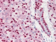 AP22852PU-N - Acinus / ACIN1