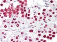 AP22852PU-N - Acinus / ACIN1