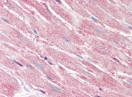 AP22860PU-N - Caspase-1
