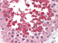 AP22860PU-N - Caspase-1