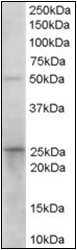 AP22571PU-N - HPGD