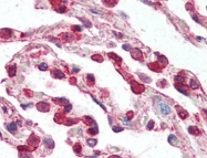 AP22847PU-N - CD193 / CCR3