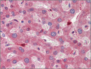 AP22572PU-N - Retinol-binding protein 1