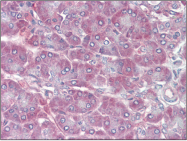 AP22572PU-N - Retinol-binding protein 1