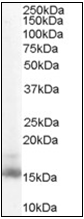 AP22572PU-N - Retinol-binding protein 1