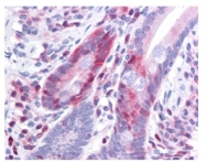 AM08441PU-N - PDCD4