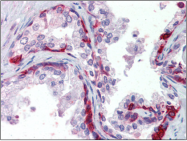 AP22580PU-N - Cytokeratin 13