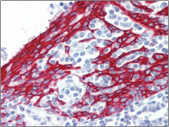 AP22580PU-N - Cytokeratin 13
