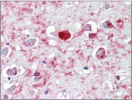 AP22584PU-N - GABAA Receptor alpha 6