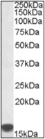 AP22585PU-N - S100A9 / Calgranulin-B / MRP14