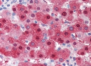 AP22845PU-N - Superoxide Dismutase 1 / SOD1