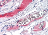 AP22821PU-N - KLKB1 / Kininogen