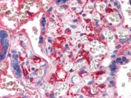 AP22822PU-N - Platelet factor 4 / PF4
