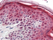AP22823PU-N - Aurora kinase B