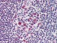 AP22823PU-N - Aurora kinase B