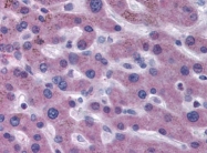 AP22826PU-N - Coagulation factor VII (F7)