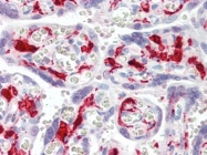 AP22828PU-N - Coagulation factor XIIIa (F13A1)