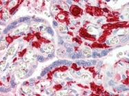 AP22829AF-N - Coagulation factor XIIIa (F13A1)
