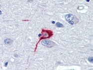 AP22830PU-N - Somatostatin / SST