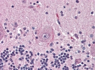 AP22832PU-N - Neurotensin receptor type 2