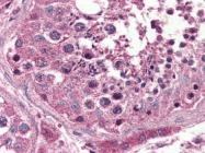 AP22837PU-N - Opsin-3