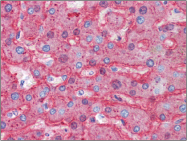 AP22590PU-N - Apolipoprotein B / Apo B