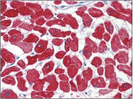 AP22593PU-N - Cardiac Troponin I