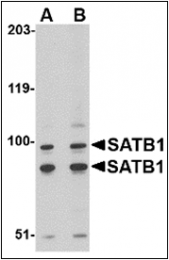 AP22599PU-N - SATB1